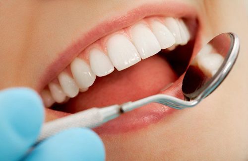 Dental Insurance – What You Should Know About Different Types Of Coverage